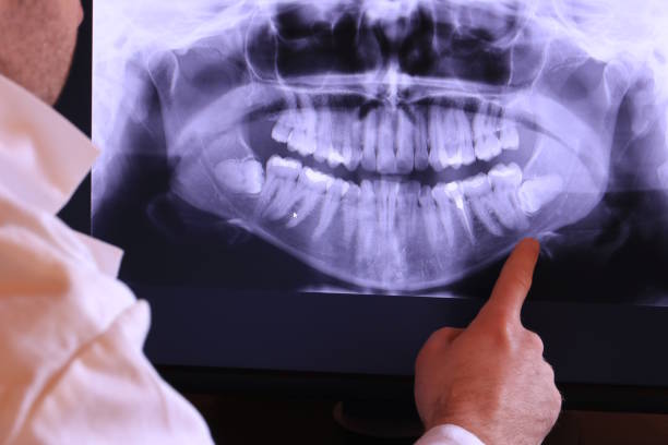 Best Dental Abscess Treatment in Killeen, TX