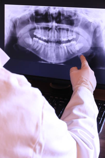 Best Emergency Root Canal Therapy in Killeen, TX